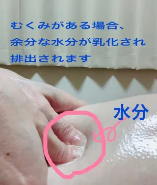 小顔・デトックスリンパ専門サロンRadiant Muse (ラディアントミューズ)所属・小顔・たるみ改善 ラディアントミューズのエステ・リラクイメージ