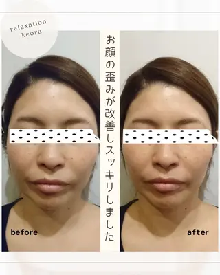 小顔矯正& 慢性肩こり腰痛改善店のエステ・リラクイメージ