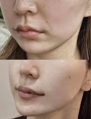 マツエク・マツパ aliaハーブ水光店 エステティシャン募集のエステ・リラクイメージ