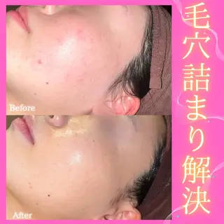 痩身&美肌サロン 堀米✨のその他イメージ