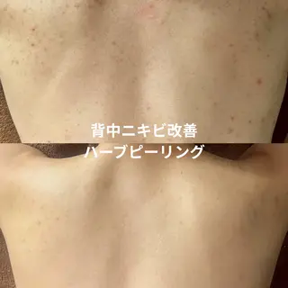 LEPUS【レプス】 sekiのエステ・リラクイメージ