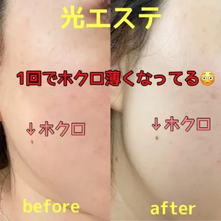 Rim リムのマツエク・マツパデザイン