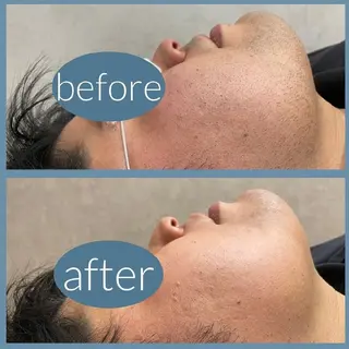 メンズ 脱毛&Beauty  K'9のエステ・リラクイメージ