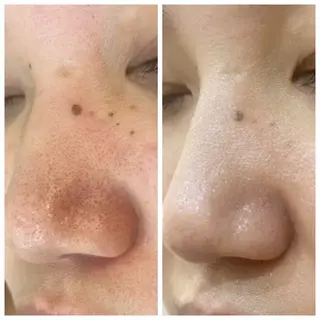 エステティックサロン YouMeのエステ・リラクイメージ