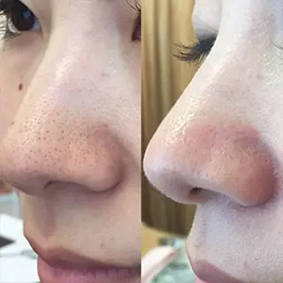 メンズ 朝重い人専用 肩甲骨調整のエステ・リラクイメージ