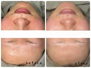 【医療提携サロン】Mbelle所属・肌質改善Mbelle 越谷レイクタウン🌿のエステ・リラクイメージ