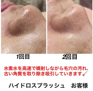 ネイル・エステサロン UILANIのネイルデザイン
