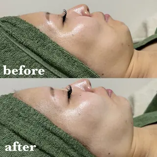 肌質改善＆脱毛 【M Mondo】のエステ・リラクイメージ