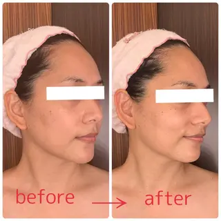 ニキビ・ニキビ跡専門 Solaのエステ・リラクイメージ