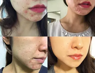 肩首こり×痩身×浄化 🌿リンパエステのエステ・リラクイメージ