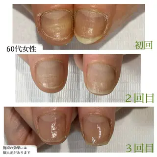 ネイル 自爪育成専門サロン エムロードゥ池下のネイルデザイン