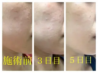 ショート カラー パーマ ヘアアレンジ キッズ ネイル マツエク・マツパ エステティック Nanagiのエステ・リラクイメージ