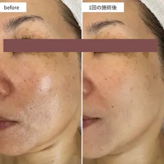 シミ・毛穴ケア専門 クロヌYUKIのエステ・リラクイメージ