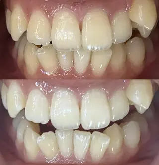 LBSホワイトニング 新宿店💎店長のエステ・リラクイメージ