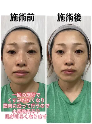 坂田 澄香のネイルデザイン