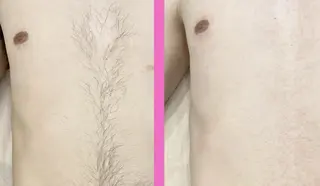 【天神・大名】脱毛/ ハーブ植松७९०のエステ・リラクイメージ