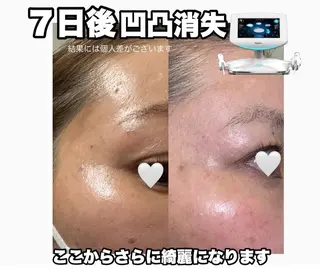 Lumiere despoirのエステ・リラクイメージ