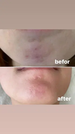 アヴニール プライベートサロンのその他イメージ