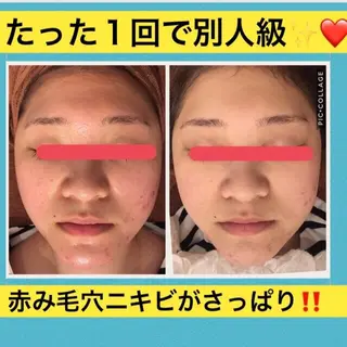 ミディアム カラー パーマ ヘアアレンジ メンズ キッズ ネイル マツエク・マツパ ニキビ・肌質改善専門 ♡人生が変わるサロンのエステ・リラクイメージ
