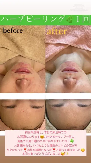 Salon de Lino 御器所のエステ・リラクイメージ