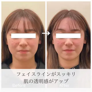 美容鍼/ヘッドスパ/ 💎さかもとのエステ・リラクイメージ