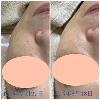 エステティック Nanagiのエステ・リラクイメージ