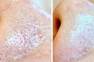 朝重い人専用 肩甲骨調整のエステ・リラクイメージ