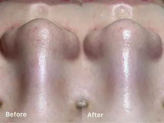 MilleTendresses所属・本町オールハンド リラク/女性専用💐のエステ・リラクイメージ