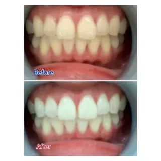 M渋谷 ホワイトニングのエステ・リラクイメージ