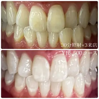 メンズ ホワイトニング ルーム　川崎店のその他イメージ