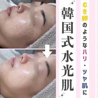 |ピーリング・毛穴| soina神楽坂のエステ・リラクイメージ