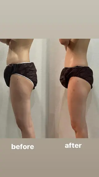 毛穴ケア専門店 BeLL ベルのエステ・リラクイメージ