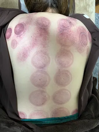 やはた鍼灸整骨院所属・やはた 鍼灸整骨院のエステ・リラクイメージ