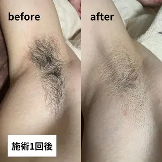 メンズ メンズ脱毛サロン 上岡　翼のエステ・リラクイメージ