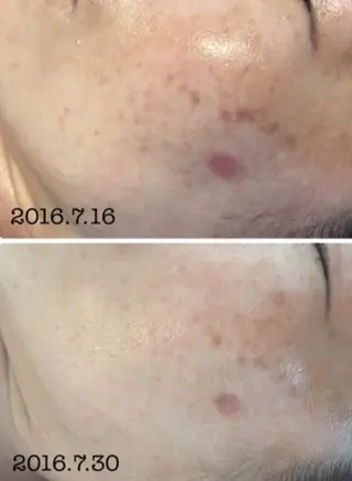 ネイル 古屋 早友里のネイルデザイン
