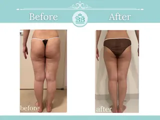 美人バスト北千住店所属・千葉 寧音のエステ・リラクイメージ