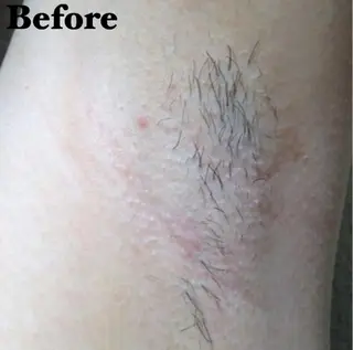 MIMI 吉祥寺本店のエステ・リラクイメージ