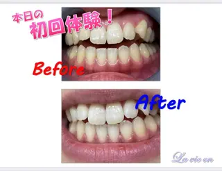 ホワイトニングサロン La vie enのその他イメージ