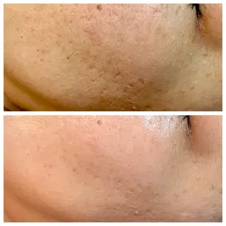 肌活＋温活サロン ハレオンナのエステ・リラクイメージ