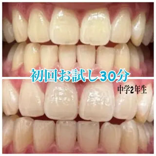 ホワイトニング🦷 ネイル💅LEAのその他イメージ