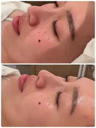 💎うる艶肌💎 スズキのエステ・リラクイメージ