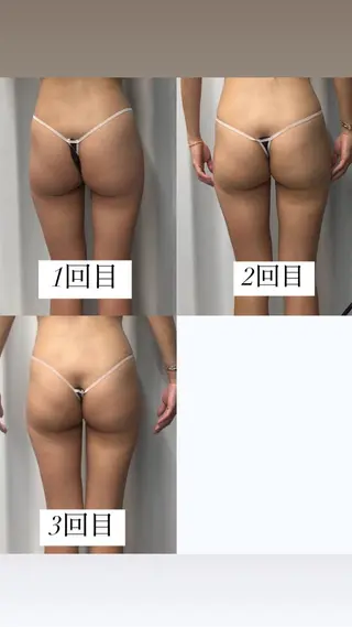 痩身・脱毛・肌管理 Rechica心斎橋のエステ・リラクイメージ