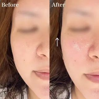 野崎 麻由美の眉毛・アイブロウイメージ