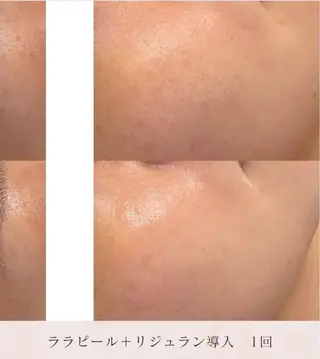 看護師が施術する美容 ナスサロshokoのエステ・リラクイメージ