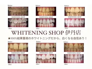 ホワイトニング ショップ伊丹店のその他イメージ