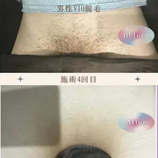 VANILLA SKYのエステ・リラクイメージ