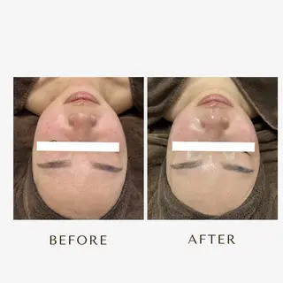 1st｜フェイシャル エステ専門店のエステ・リラクイメージ