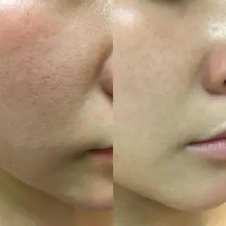 y.laBelle 艶肌・小顔・肌質改善のエステ・リラクイメージ