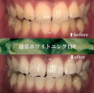 futaba ホワイトニング/天神のエステ・リラクイメージ