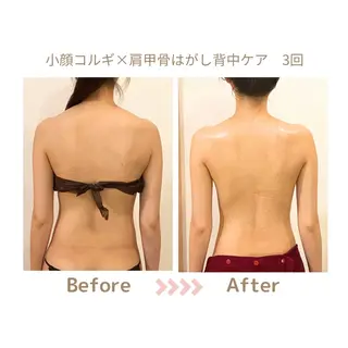 肌質改善×小顔サロン リトリト垣内のエステ・リラクイメージ